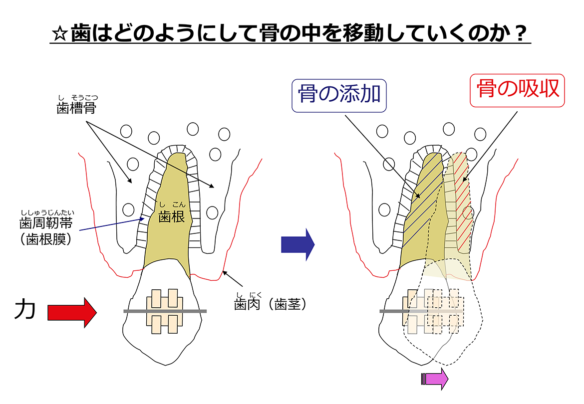 歯はどのようにして骨の中を移動していくのか？