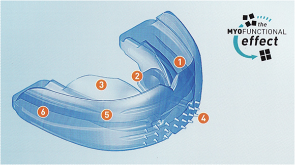 図：歯列矯正用咬合誘導装置 口腔筋機能トレーナー